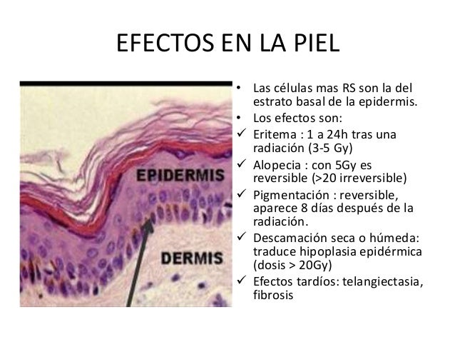 Efectos biologicos de las radiaciones ionizantes Efectos biologicos de las radiaciones ionizantes