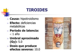 TIROIDES
 Causa: hipotiroidismo
 Efecto: deficiencias
metabólicas
 Período de latencia:
 1 año
 Umbral aproximado
(Gy): 5.0
 Dosis que produce
efectos severos: 10.0
 