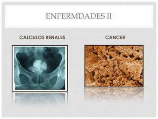 ENFERMEDADES CAUSADAS POR LA CONTAMINACION del agua