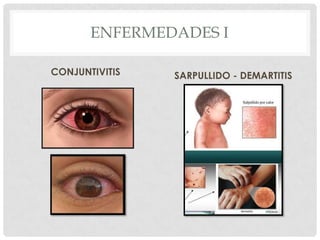 ENFERMEDADES CAUSADAS POR LA CONTAMINACION DEL AIRE