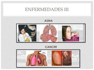 Enfermedades IIBRONQUITISGRIPE