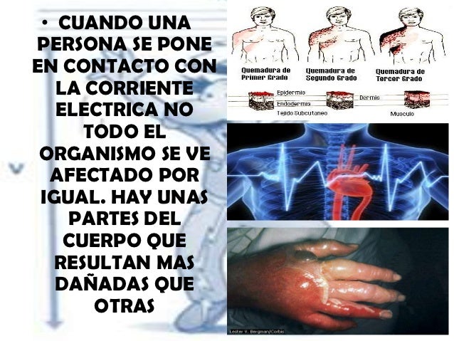 Efectos de la corriente sobre el cuerpo humano exp