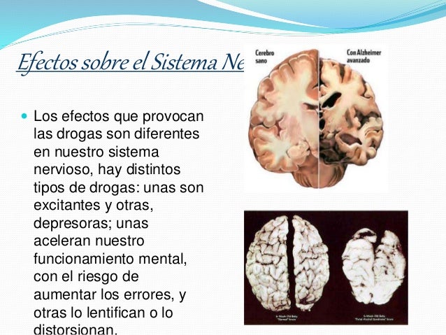 El desarrollo del alcoholismo a los hombres