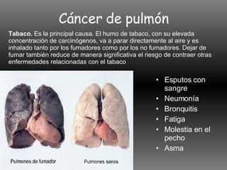 Cáncer de pulmón Esputos con sangre Neumonía Bronquitis Fatiga Molestia en el pecho Asma Tabaco.  Es la principal causa. El humo de tabaco, con su elevada concentración de carcinógenos, va a parar directamente al aire y es inhalado tanto por los fumadores como por los no fumadores. Dejar de fumar también reduce de manera significativa el riesgo de contraer otras enfermedades relacionadas con el tabaco  
