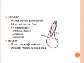    Extrusión
     Mismos efectos que erupción
     Altura de inserción ósea
     FF inapropiadas
         Pérdida de fijación
         Anquilosis

         reabsorción


   Intrusión
     Mismo porcentaje enterrado
     Deseable mejorar sujeción ósea
 