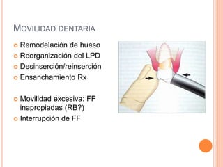 MOVILIDAD DENTARIA
 Remodelación de hueso
 Reorganización del LPD

 Desinserción/reinserción

 Ensanchamiento Rx



 Movilidad excesiva: FF
  inapropiadas (RB?)
 Interrupción de FF
 