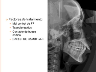    Factores de tratamiento:
     Mal control de FF
     Tx prolongados
     Contacto de hueso
      cortical
     CASOS DE CAMUFLAJE
 