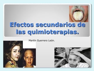 Efectos secundarios de las quimioterapias. Martín Guerrero León. 