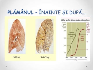 PLĂMÂNUL – ÎNAINTE ŞI DUPĂ...
 