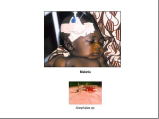 Caminhos da Ciência, Tecnologia e Sociedade (UTL) - Efeito Borboleta - Teoria do Caos e Epidemias