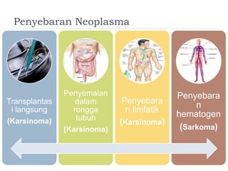 Penyebaran Neoplasma

Transplantas
i langsung
(Karsinoma)

Penyemaian
dalam
rongga
tubuh
(Karsinoma)

Penyebara
n limfatik
(Karsinoma)

Penyebara
n
hematogen
(Sarkoma)

 