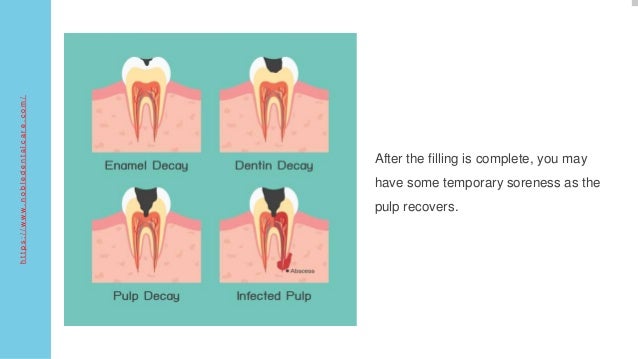 Effective Remedies for Pulpitis - How To Treat Swimming Pool Pulpitis