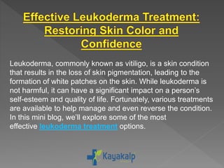 Leukoderma, commonly known as vitiligo, is a skin condition
that results in the loss of skin pigmentation, leading to the
formation of white patches on the skin. While leukoderma is
not harmful, it can have a significant impact on a person’s
self-esteem and quality of life. Fortunately, various treatments
are available to help manage and even reverse the condition.
In this mini blog, we’ll explore some of the most
effective leukoderma treatment options.
 