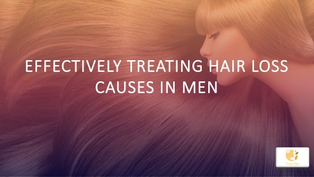Effectively Treating Hair Loss Causes In Men