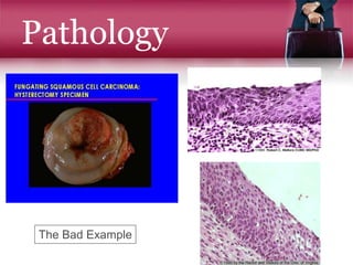 Pathology
The Bad Example
 