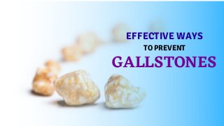 EFFECTIVE WAYS
TO PREVENT
GALLSTONES
 