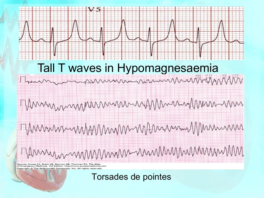 Effect of electrolytes on cardiac rhythm