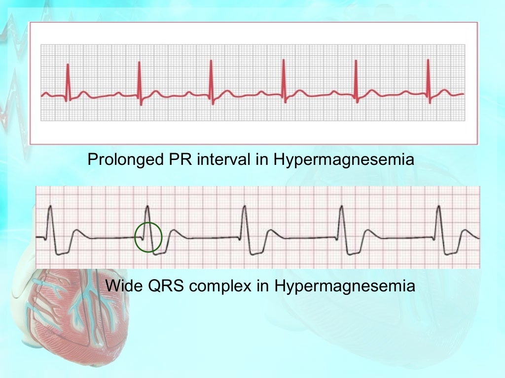 Effect of electrolytes on cardiac rhythm