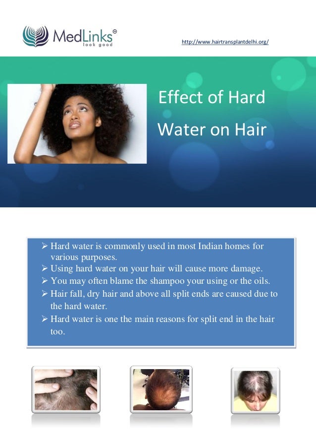 Effect of Hard Water on Hair
