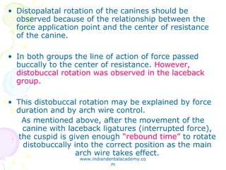 PDF] Effectiveness of laceback ligatures on maxillary canine retraction.