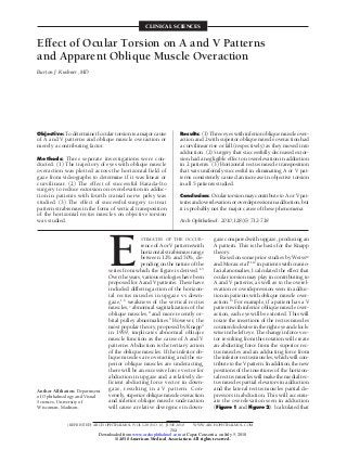 CLINICAL SCIENCES
Effect of Ocular Torsion on A and V Patterns
and Apparent Oblique Muscle Overaction
Burton J. Kushner, MD
Objective: To determine if ocular torsion is a major cause
of A and V patterns and oblique muscle overaction or
merely a contributing factor.
Methods: Three separate investigations were con-
ducted. (1) The trajectory of eyes with oblique muscle
overaction was plotted across the horizontal field of
gaze from videographs to determine if it was linear or
curvilinear. (2) The effect of successful Harada-Ito
surgery to reduce extorsion on overelevation in adduc-
tion in patients with fourth cranial nerve palsy was
studied. (3) The effect of successful surgery to treat
pattern strabismus in the form of vertical transposition
of the horizontal rectus muscles on objective torsion
was studied.
Results: (1) Three eyes with inferior oblique muscle over-
action and 2 with superior oblique muscle overaction had
a curvilinear rise or fall (respectively) as they moved into
adduction. (2) Surgery that successfully decreased extor-
sion had a negligible effect on overelevation in adduction
in 2 patients. (3) Horizontal rectus muscle transposition
that was uniformly successful in eliminating A or V pat-
terns consistently caused an increase in objective torsion
in all 5 patients studied.
Conclusion: Ocular torsion may contribute to A or V pat-
ternsandoverelevationoroverdepressioninadduction,but
it is probably not the major cause of these phenomena.
Arch Ophthalmol. 2010;128(6):712-718
E
STIMATES OF THE OCCUR-
rence of A or V patterns with
horizontal strabismus range
between 12% and 50%, de-
pending on the nature of the
series from which the figure is derived.1-5
Overtheyears,variousetiologieshavebeen
proposed for A and V patterns. These have
included differing action of the horizon-
tal rectus muscles in upgaze vs down-
gaze,1,6
weakness of the vertical rectus
muscles,7
abnormal sagittalization of the
oblique muscles,8
and more recently or-
bital pulley abnormalities.9
However, the
most popular theory, proposed by Knapp2
in 1959, implicates abnormal oblique
muscle function as the cause of A and V
patterns. Abduction is the tertiary action
of the oblique muscles. If the inferior ob-
lique muscles are overacting and the su-
perior oblique muscles are underacting,
there will be an excessive force vector for
abduction in upgaze and a relatively de-
ficient abducting force vector in down-
gaze, resulting in a V pattern. Con-
versely,superiorobliquemuscleoveraction
and inferior oblique muscle underaction
will cause a relative divergence in down-
gaze compared with upgaze, producing an
A pattern. This is the basis for the Knapp
theory.
Based on some prior studies by Weiss10
and Morax et al11,12
in patients with cranio-
facial anomalies, I calculated the effect that
ocular torsion may play in contributing to
A and V patterns, as well as to the overel-
evation or overdepression seen in adduc-
tion in patients with oblique muscle over-
action.13
For example, if a patient has a V
pattern with inferior oblique muscle over-
action, each eye will be extorted. This will
rotate the insertions of the rectus muscles
counterclockwiseintherighteyeandclock-
wiseinthelefteye.Thechangeinforcevec-
tor resulting from this rotation will create
an abducting force from the superior rec-
tus muscles and an adducting force from
the inferior rectus muscles, which will con-
tributetotheVpattern.Inaddition,thenew
positions of the insertions of the horizon-
tal rectus muscles will make the medial rec-
tus muscles partial elevators in adduction
and the lateral rectus muscles partial de-
pressors in abduction. This will accentu-
ate the overelevation seen in adduction
(Figure 1 and Figure 2). I calculated that
Author Affiliation: Department
of Ophthalmology and Visual
Sciences, University of
Wisconsin, Madison.
(REPRINTED) ARCH OPHTHALMOL/VOL 128 (NO. 6), JUNE 2010 WWW.ARCHOPHTHALMOL.COM
712
©2010 American Medical Association. All rights reserved.
at Capes Consortia, on July 5, 2010www.archophthalmol.comDownloaded from
 