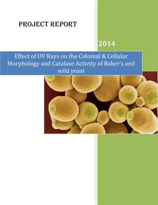 Project Report
2014
Effect of UV Rays on the Colonial & Cellular
Morphology and Catalase Activity of Baker’s and
wild yeast
 