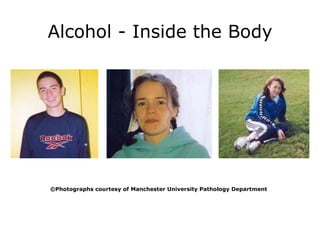 Alcohol - Inside the Body © Photographs courtesy of Manchester University Pathology Department 