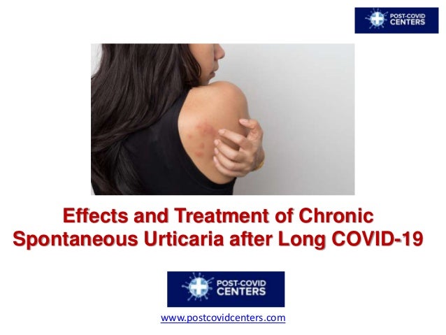 Effects and Treatment of Chronic
Spontaneous Urticaria after Long COVID-19
www.postcovidcenters.com
 