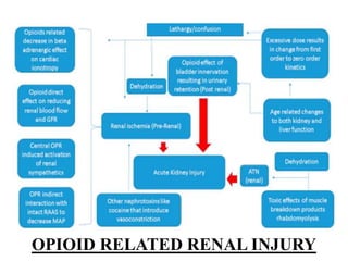 OPIOID RELATED RENAL INJURY
 