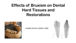 Effects of Bruxism on Dental
Hard Tissues and
Restorations
HUSNE DUYGU CARKCI, DDM
 