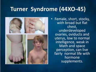 Effects of changes in sex chromosomes number | PPTX