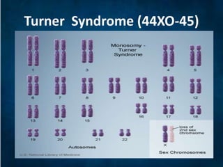 Effects of changes in sex chromosomes number | PPTX