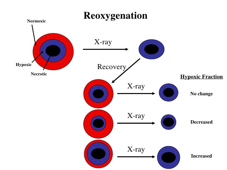 Effects Of Oxygen On Radiation Therapy