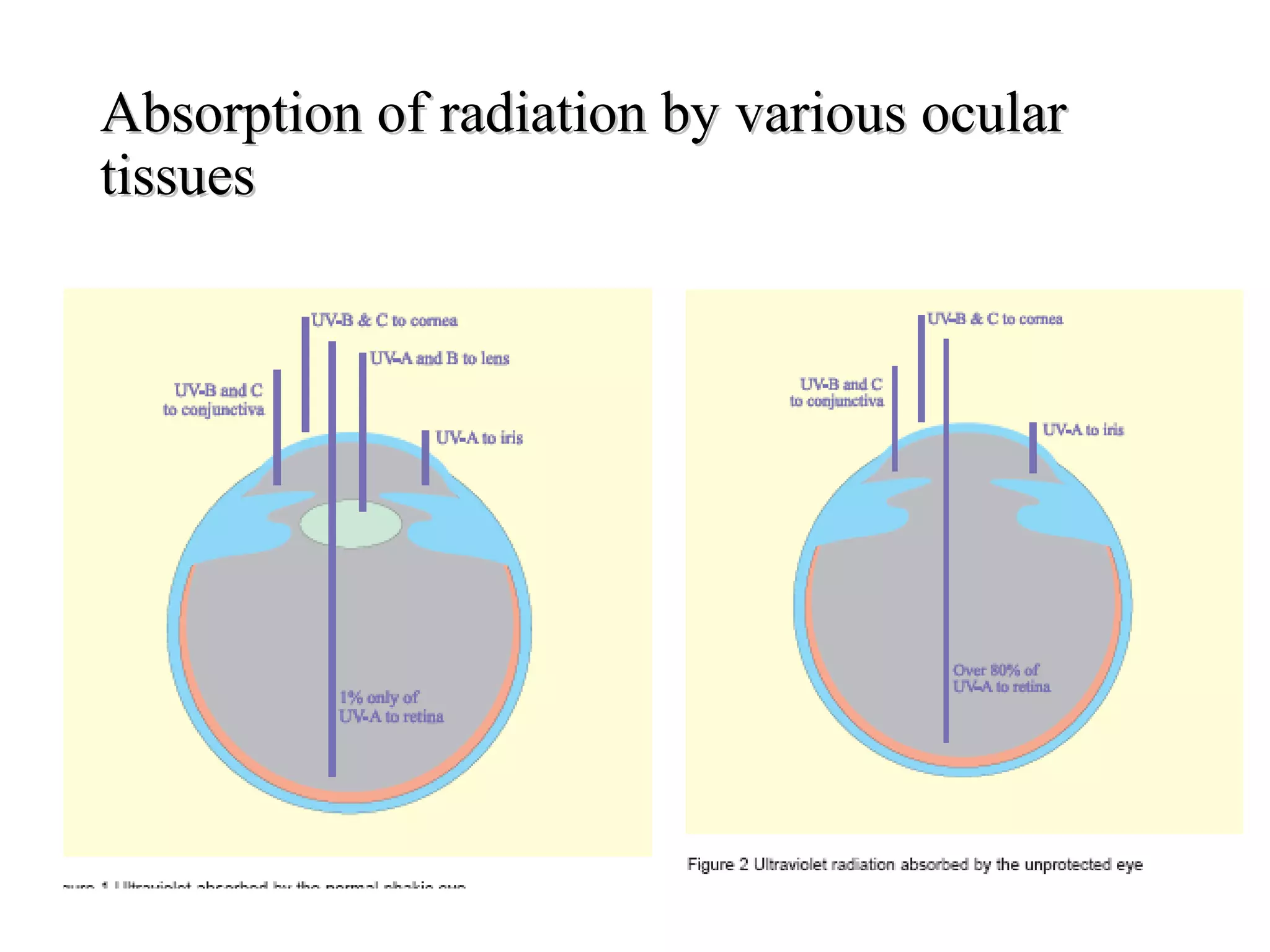 Absorption of radiation by various ocularAbsorption of radiation by various ocular
tissuestissues
 