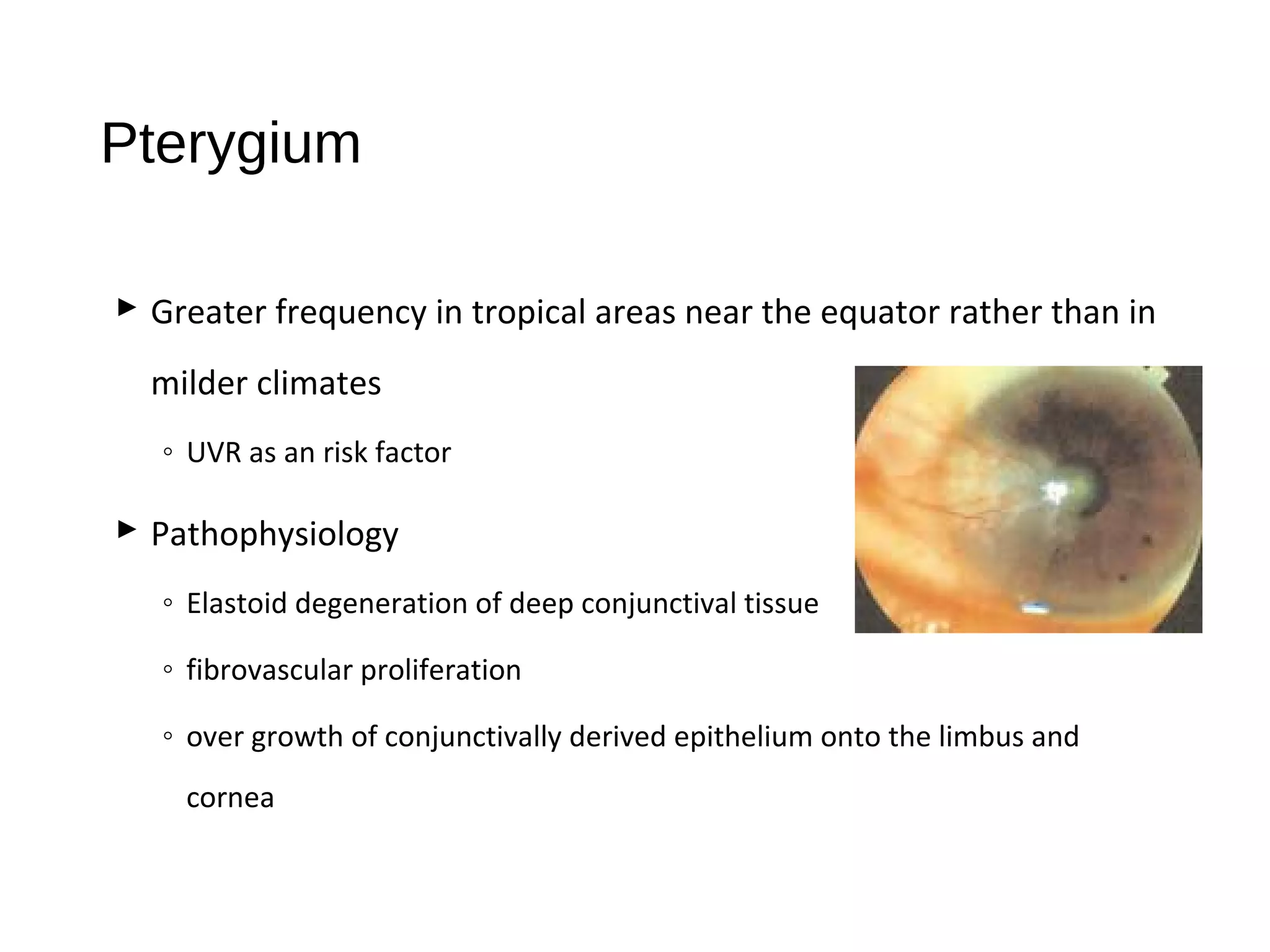 Pterygium
 Greater frequency in tropical areas near the equator rather than in
milder climates
◦ UVR as an risk factor
 Pathophysiology
◦ Elastoid degeneration of deep conjunctival tissue
◦ fibrovascular proliferation
◦ over growth of conjunctivally derived epithelium onto the limbus and
cornea
 