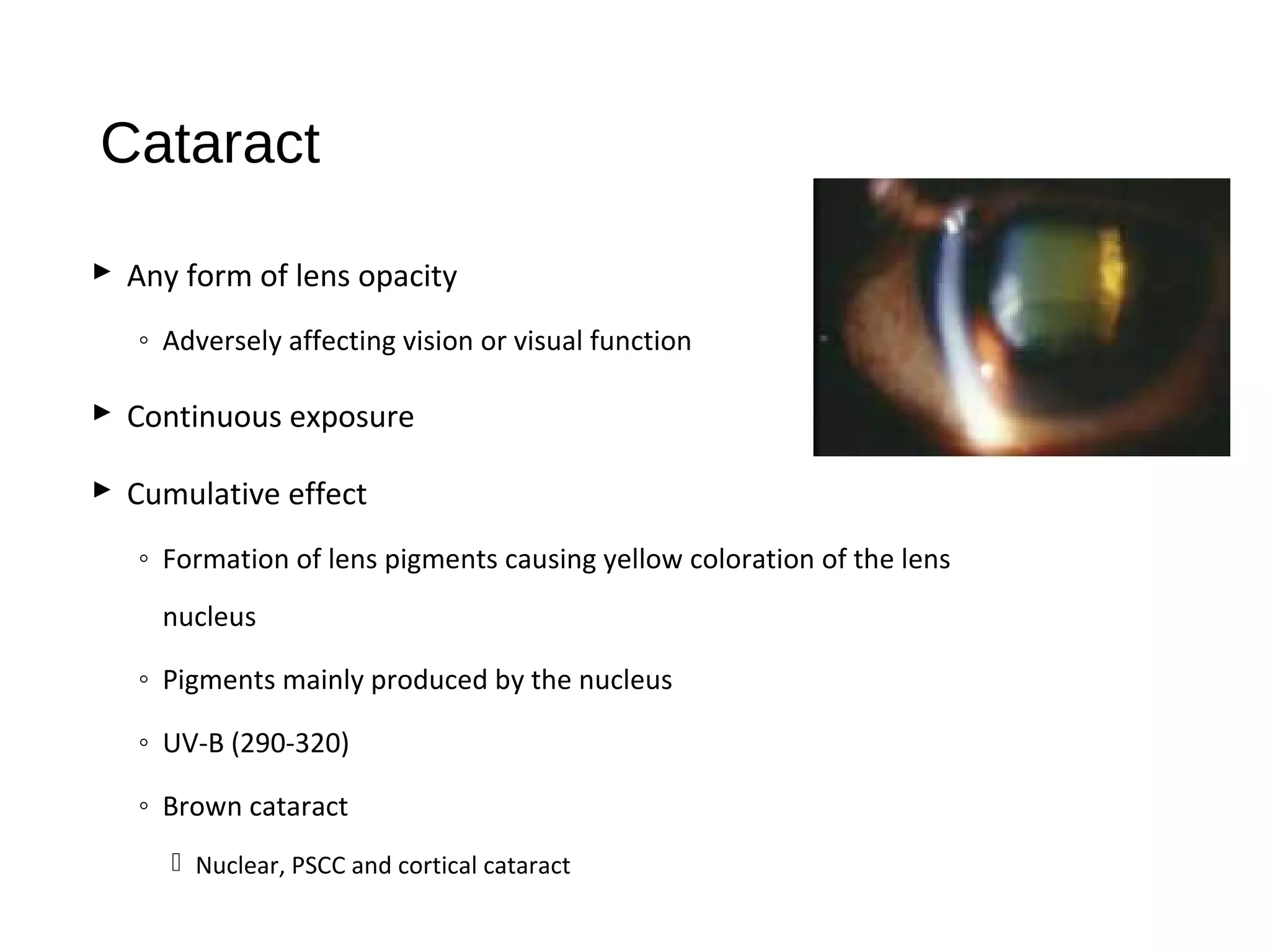 Cataract
 Any form of lens opacity
◦ Adversely affecting vision or visual function
 Continuous exposure
 Cumulative effect
◦ Formation of lens pigments causing yellow coloration of the lens
nucleus
◦ Pigments mainly produced by the nucleus
◦ UV-B (290-320)
◦ Brown cataract
 Nuclear, PSCC and cortical cataract
 