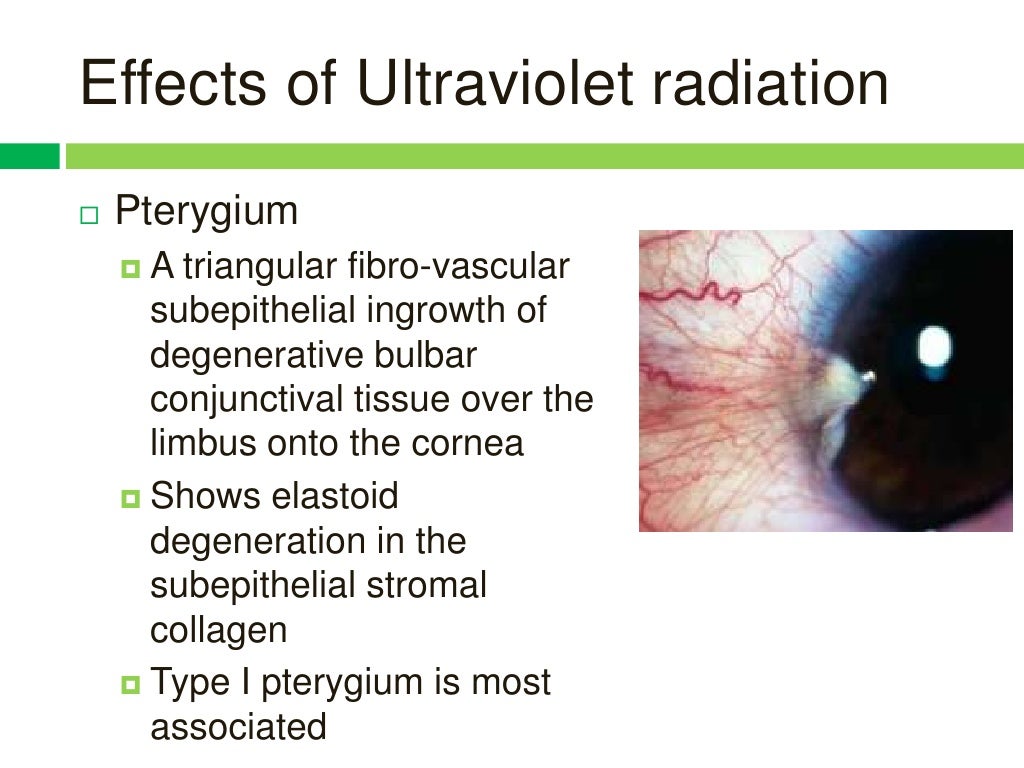 Effects of radiation and glare on human eyes