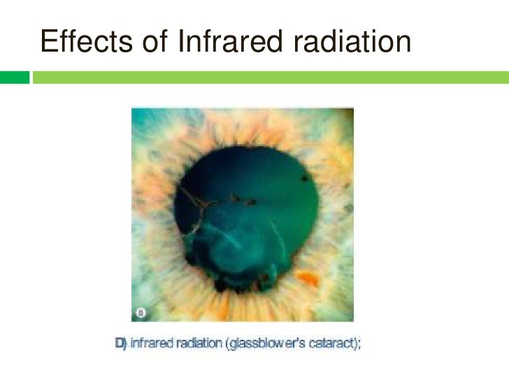 Effects of radiation and glare on human eyes