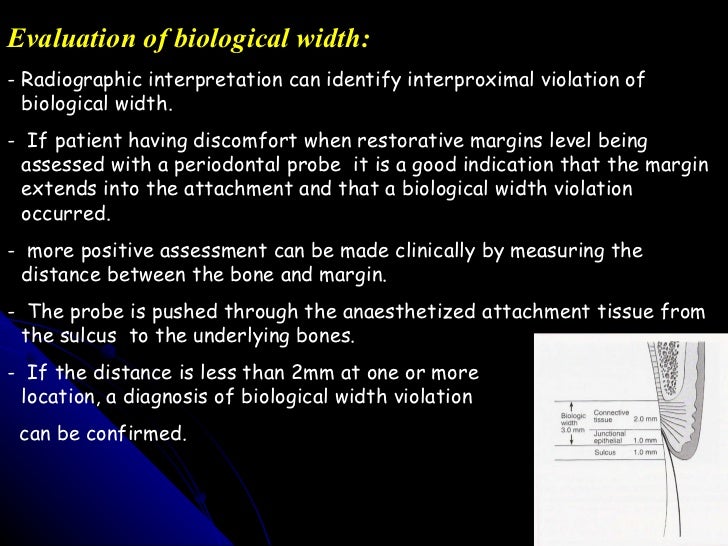 10 evaluation of biological width