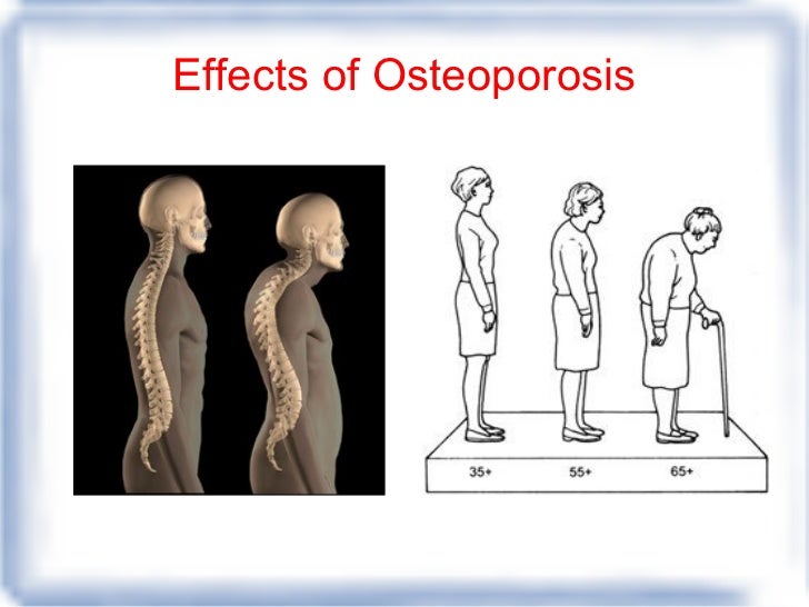 Effects of smoking third try