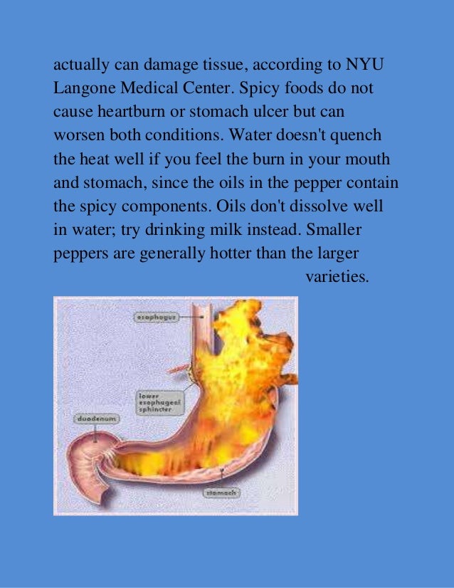 Can You Eat Spicy Food With A Stomach Ulcer Can You Eat Spicy Food With A Stomach Ulcer