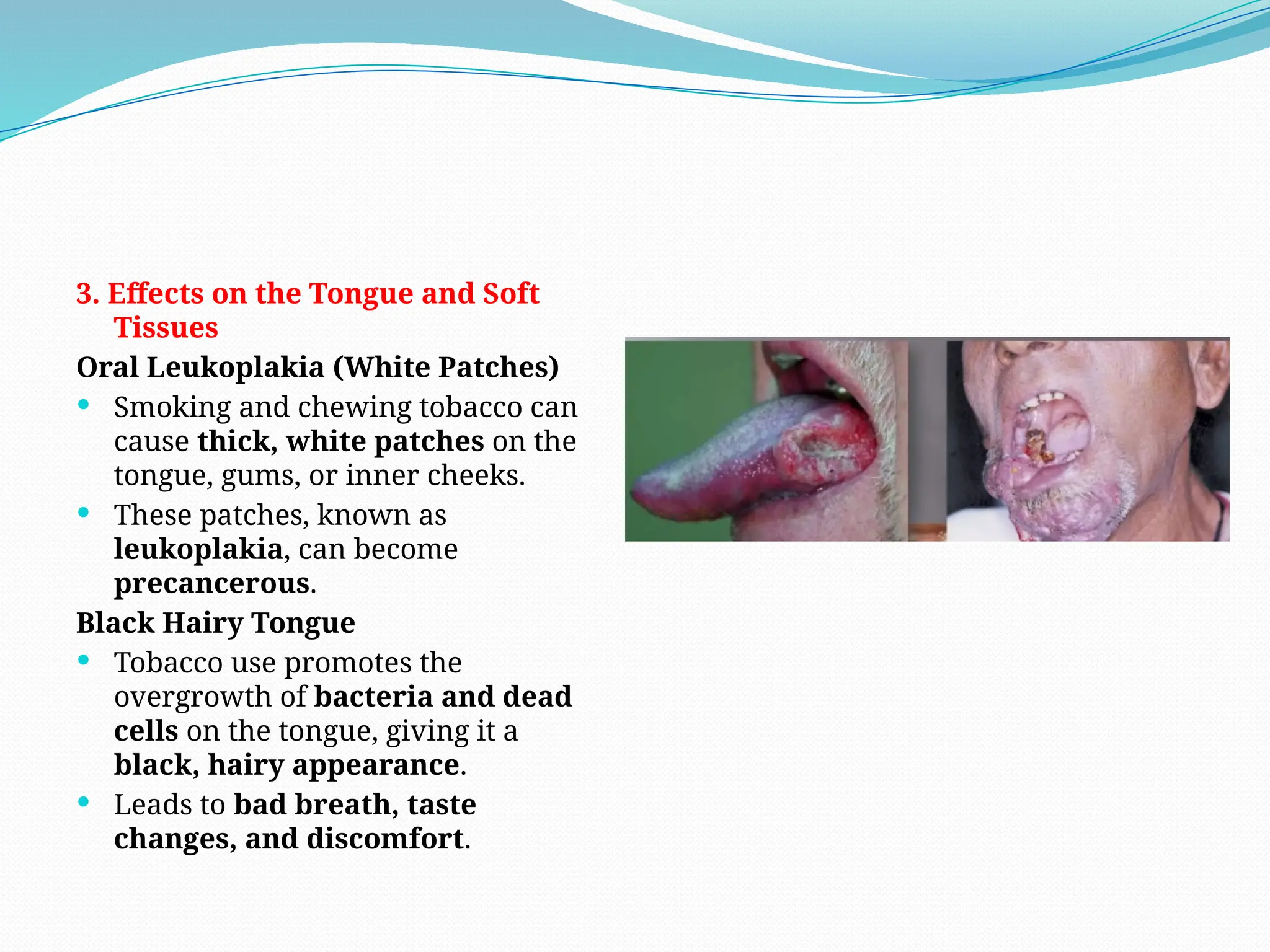 why does chewing tobacco give me heartburn Smokeless Really Affect Acid Reflux? Comprehensive Analysis of Tobacco's Impact