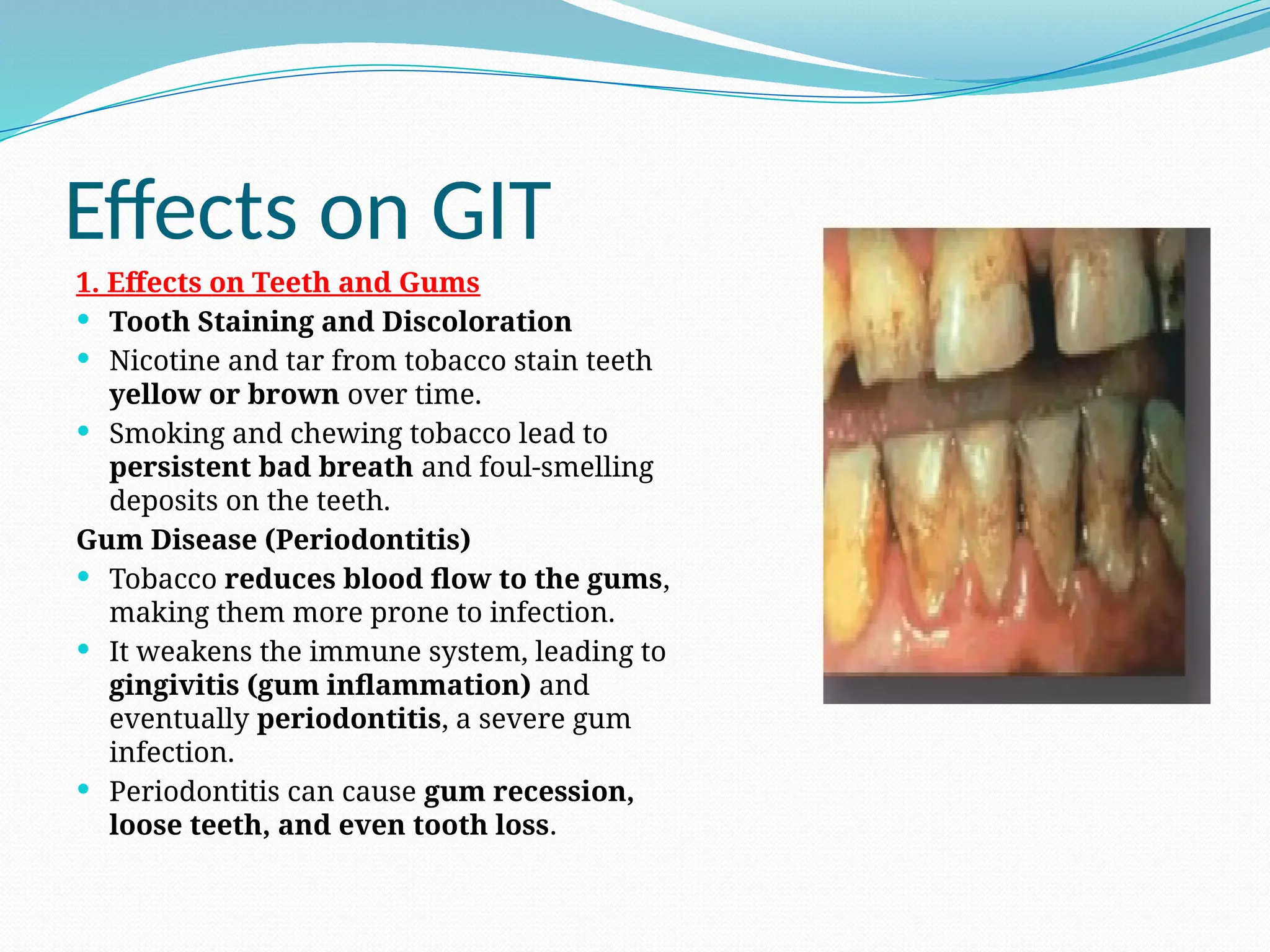 can chewing tobacco cause gastritis Chewing Tobacco and Its Harmful Effects on Oral Health Does Smoking & Chewing Tobacco