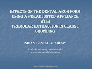 Effects on the Dental Arch Form
Using a Preadjusted Appliance
with
Premolar Extraction in Class I
Crowding
INDIAN DENTAL ACADEMY
Leader in continuing dental education
www.indiandentalacademy.com
www.indiandentalacademy.com
 