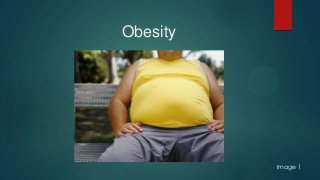 Obesity
Image 1
 