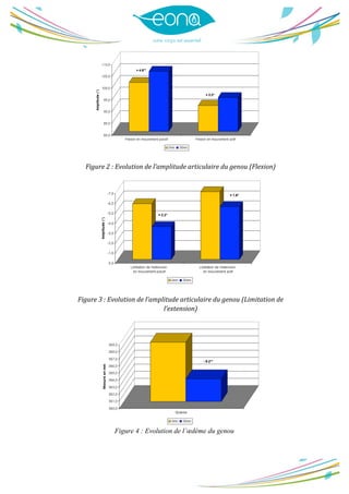  
	
  
	
  
Figure	
  2	
  :	
  Evolution	
  de	
  l’amplitude	
  articulaire	
  du	
  genou	
  (Flexion)	
  
	
  
Figure	
  3	
  :	
  Evolution	
  de	
  l’amplitude	
  articulaire	
  du	
  genou	
  (Limitation	
  de	
  
l’extension)	
  
Figure 4 : Evolution de l’œdème du genou
 