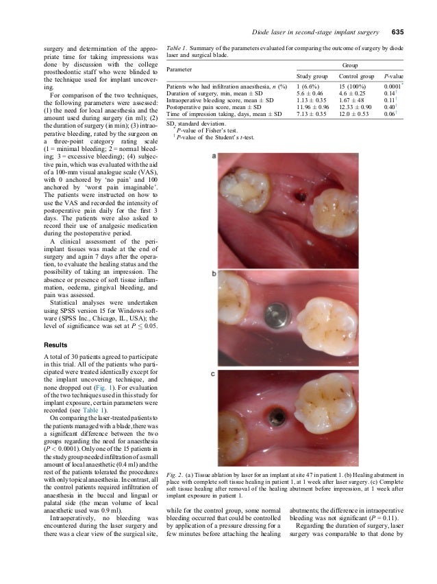 Efficacy and safety of a diode laser in second stage implant surgery