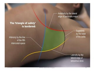 5/17/2023 MUHAS, Department of Surgery 43
 