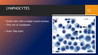 LYMPHOCYTES
• Small cells with a single round nucleus
• Thin rim of cytoplasm.
• Stain: Pap stain
12
 