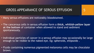GROSS APPEARANCE OF SEROUS EFFUSION
• Many serous effusions are noticeably bloodstained.
• The cancerous cells in serous effusion form a thick, whitish-yellow layer
at the bottom of container when allowed to stand and sediment
spontaneously.
• Individual particles of cancer in a serous effusion may occasionally be large
enough to be visible to the naked eye. Eg: spheroids, ellipsoids .
• Fluids containing numerous pigmented melanoma cells may be chocolate
brown.
5
 